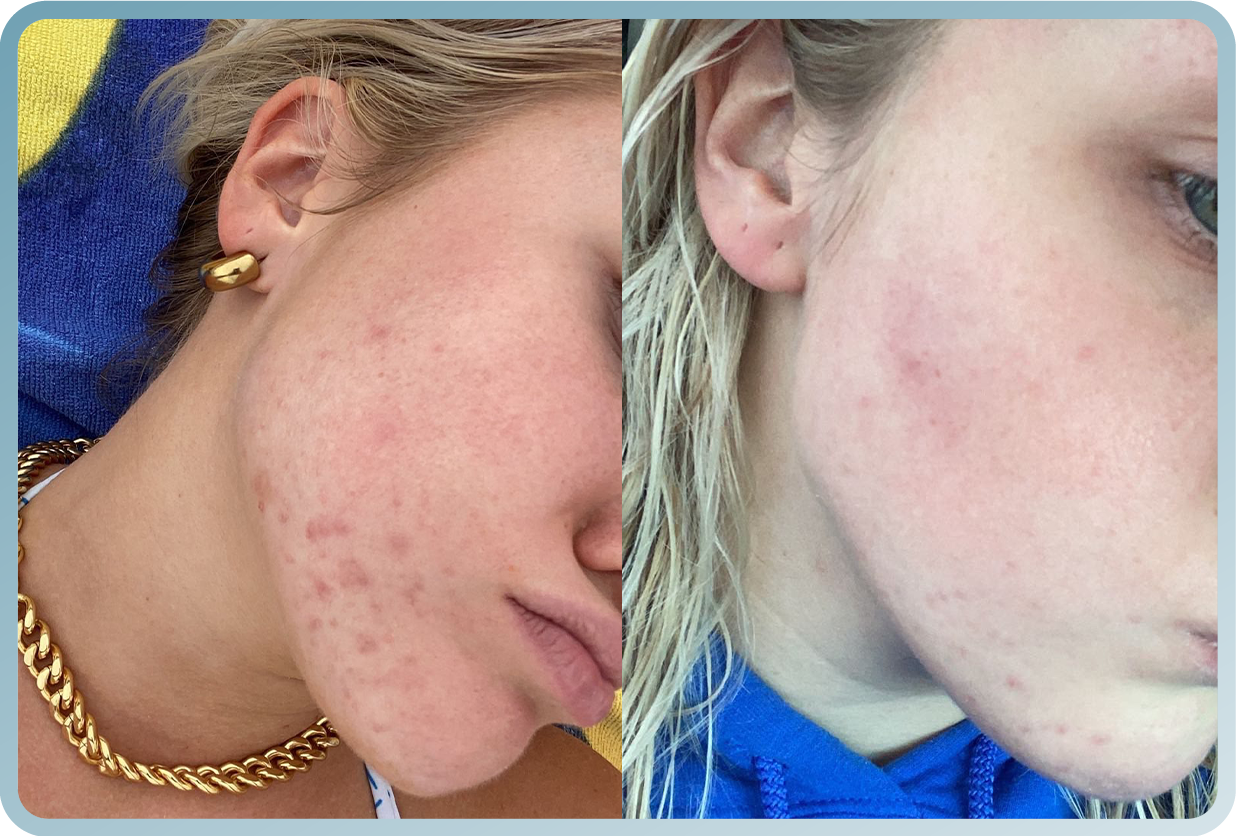 Advanced Skin Repair Treatment - RecoverX Skincare